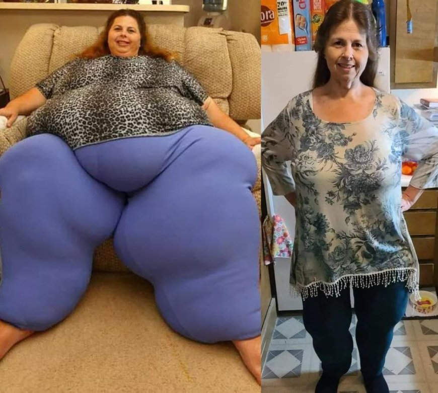 My 600lb Life star shows off epic weight loss after being crowned World’s Heaviest ­Woman